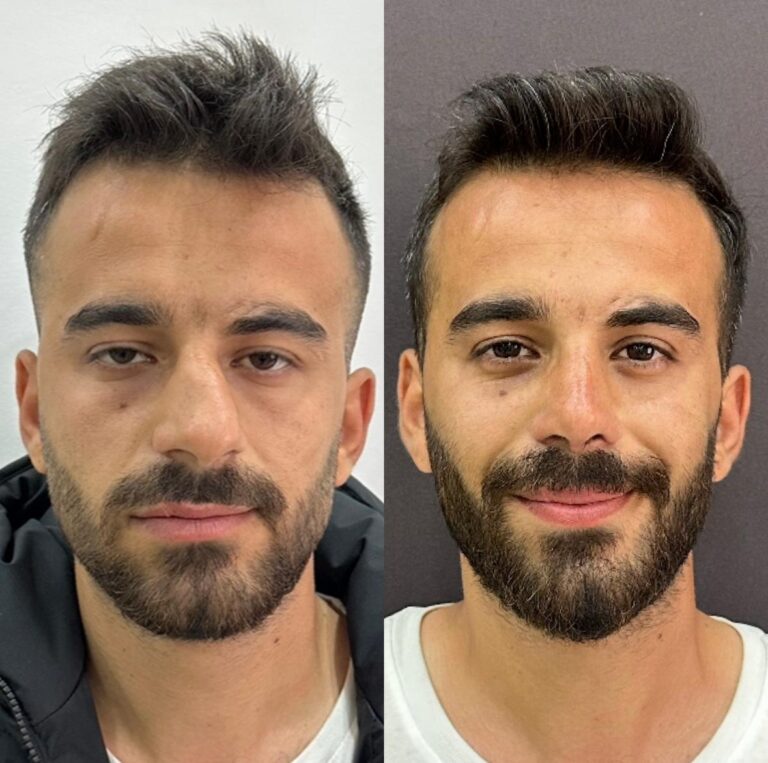 op dr aykut taşdemir